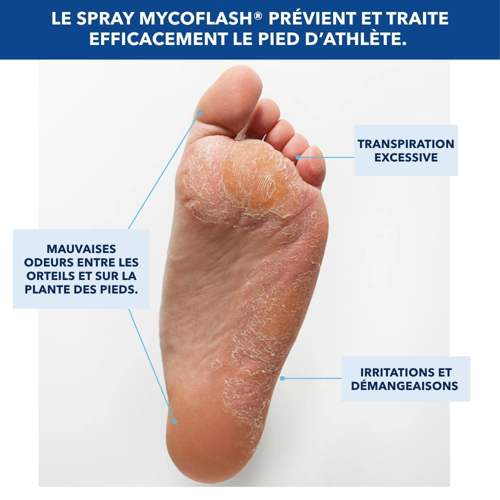 MYCOFLASH® - Spray Antifongique pour le Pied d'Athlète